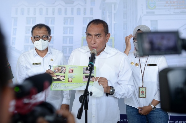 Gubernur Sumut, Edy Rahmayadi, memberikan keterangan terkait PMK